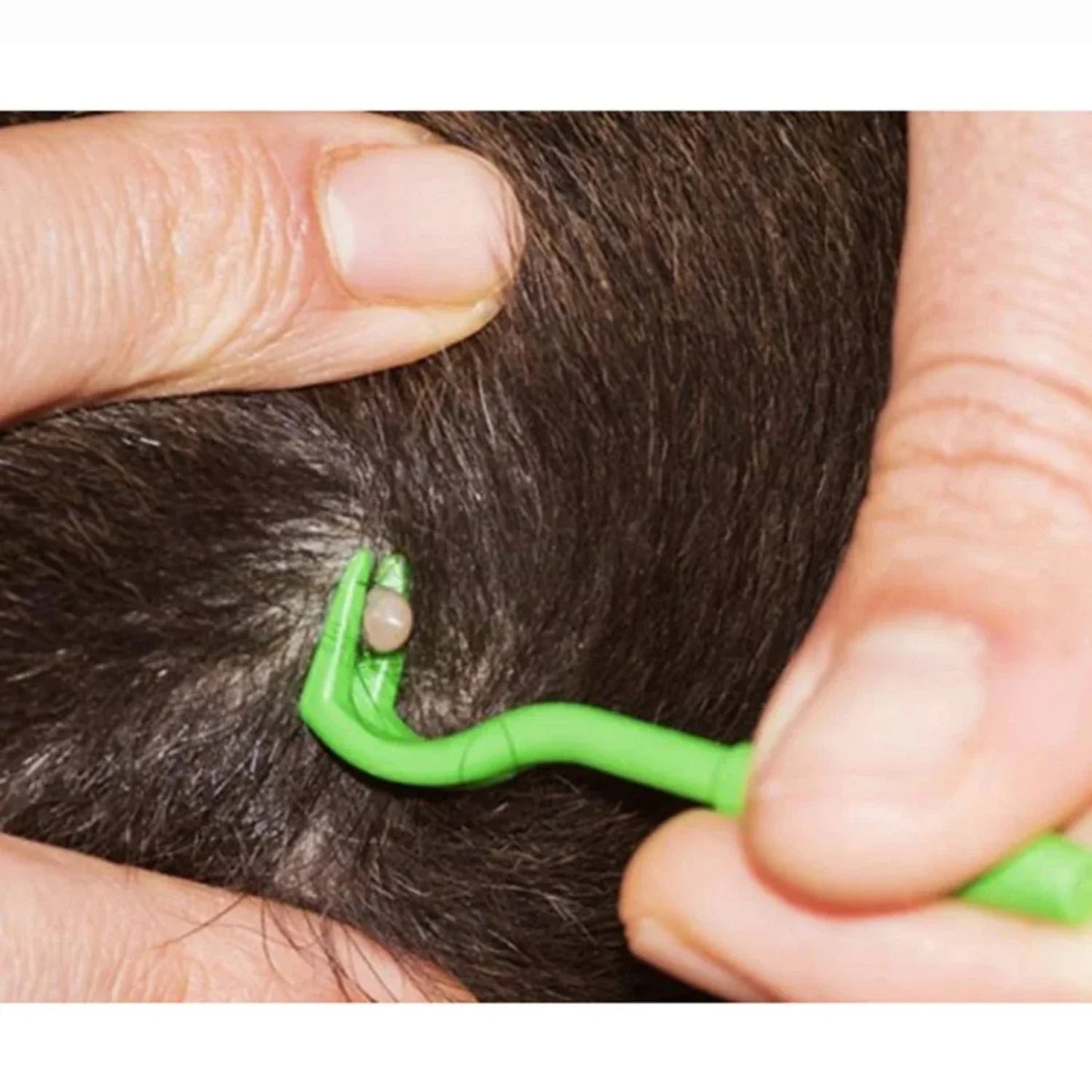 PetSafe™ Tick Removal Tool for Dogs & Humans - Quick & Easy Tick Extractor