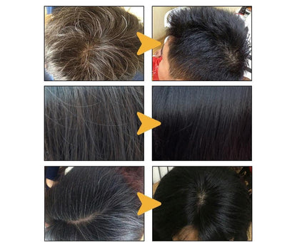 ReviveGray™ Anti-Gray Hair Shampoo Bar Soap for All Hair Types