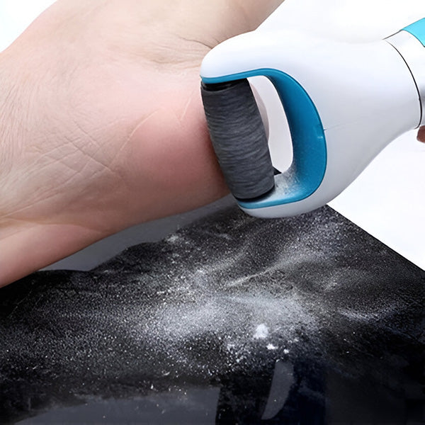 SmoothFeet™ Electric Callus Remover for Feet – Gentle Foot Care at Home 2