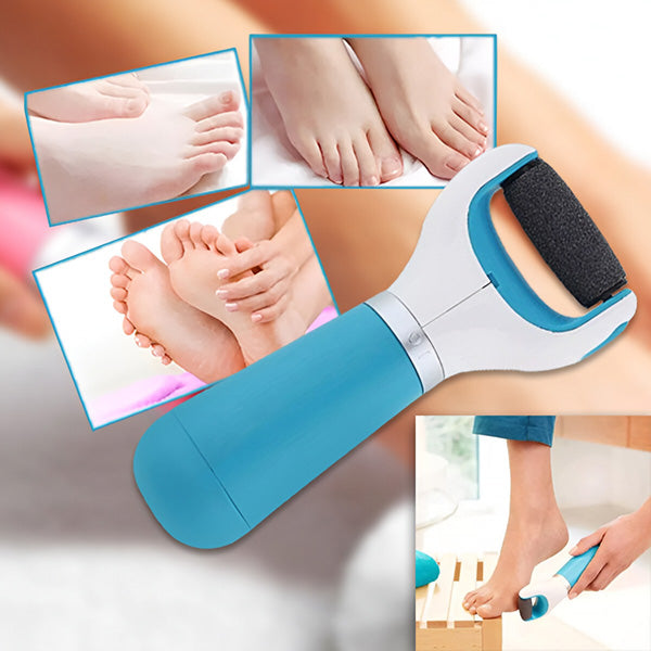SmoothFeet™ Electric Callus Remover for Feet – Gentle Foot Care at Home 3