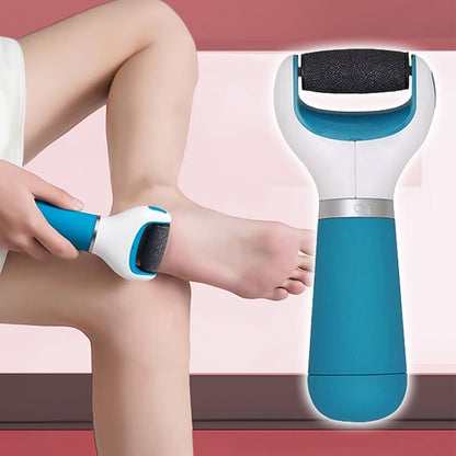 SmoothFeet™ Electric Callus Remover for Feet – Gentle Foot Care at Home 5