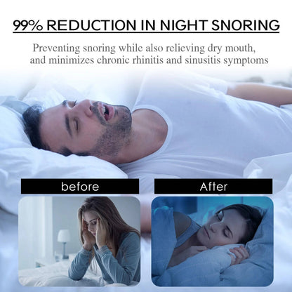 SleepWell™ Mouth Tape for Sleep - Best Anti-Snoring Solution for Restful Nights 2